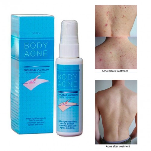 Спрей против Акне на теле очищающий Mistine, 50 мл. Таиланд